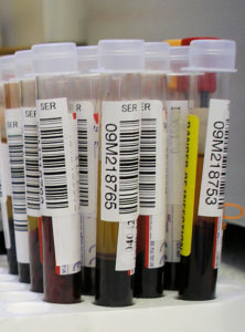 Blood Testing for Hormones