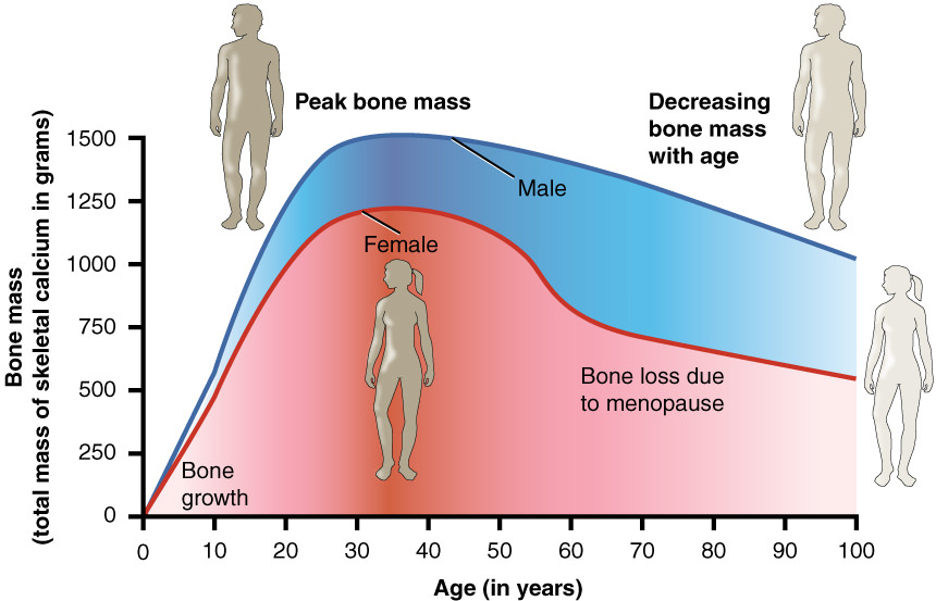 615_Age_and_Bone_Mass