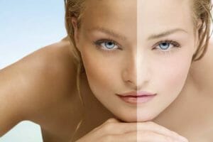 Pale vs Tan Skin