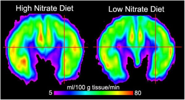 Your Brain on Nitrates